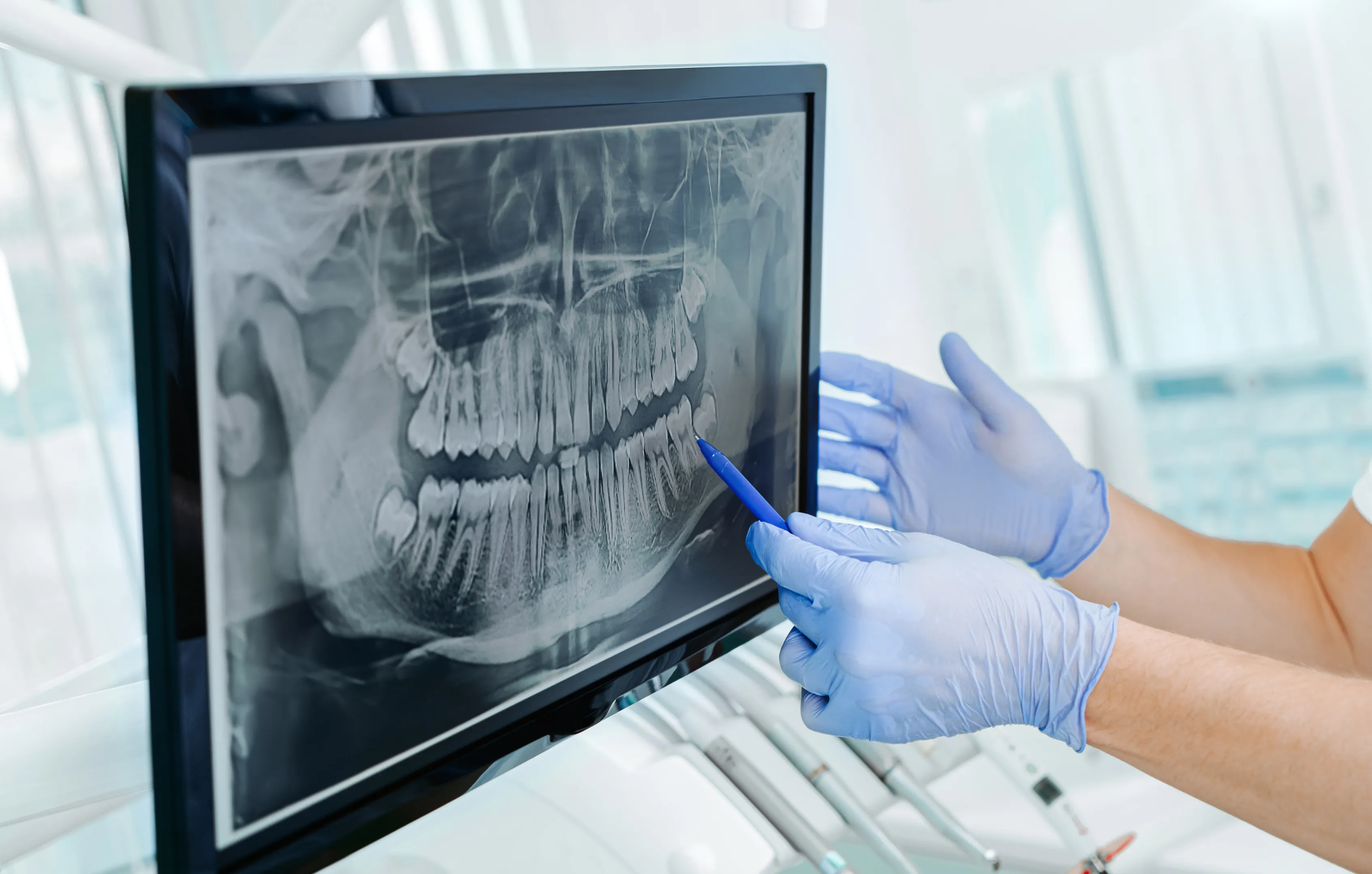 Dentist reviewing a panoramic dental X-ray