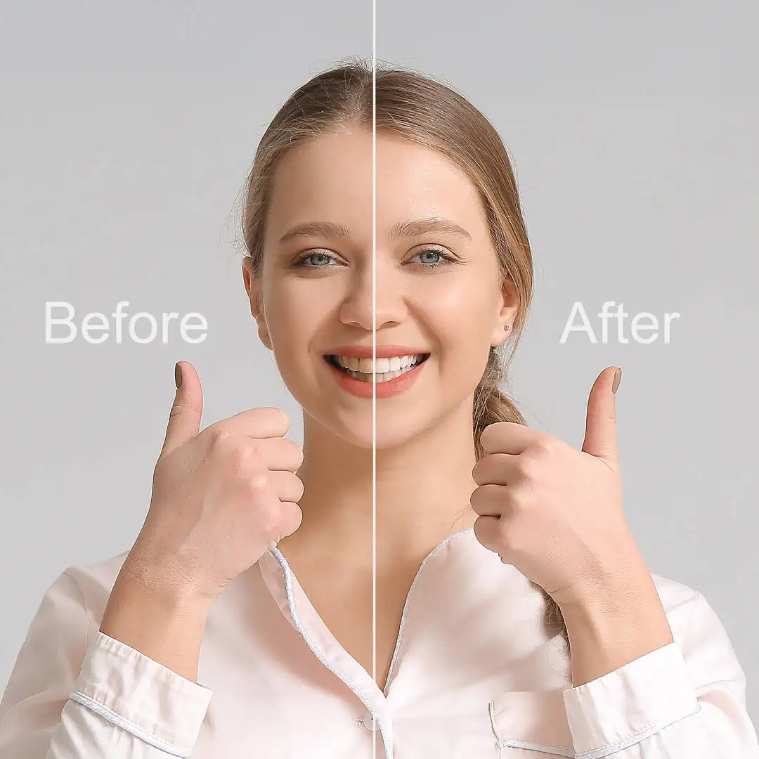 Bright, confident smile after a cosmetic smile makeover