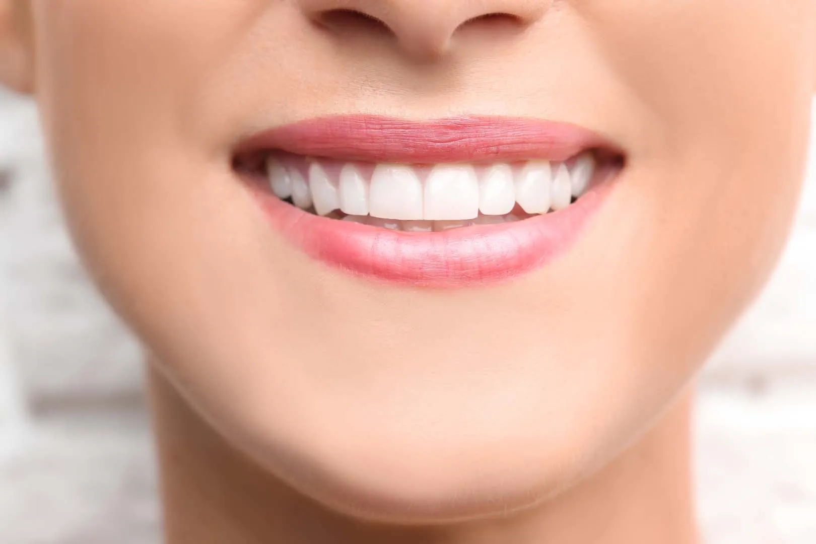 Professional Teeth Whitening